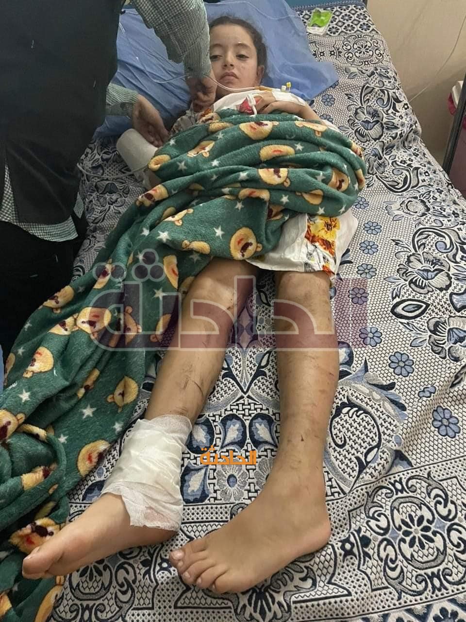 أحد الأطفال المصابين