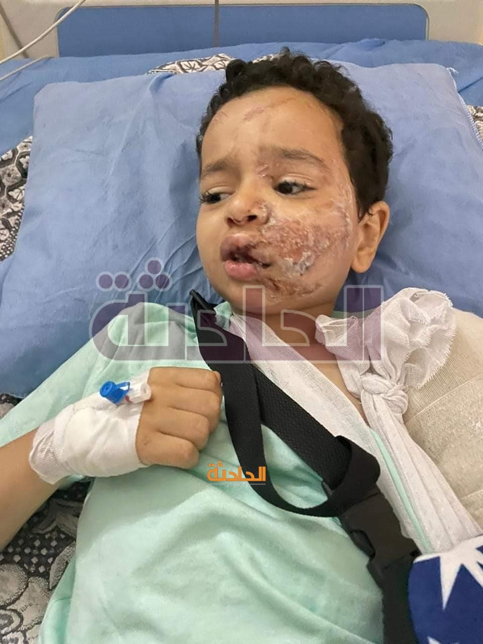 أحد الأطفال المصابين