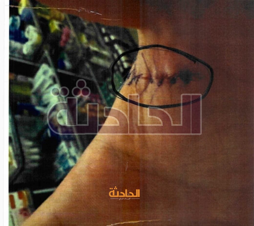 مشاجرة �بالأمواس� داخل صالون حلاقة شهير بالتجمع الأول