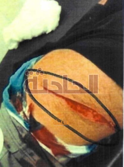 مشاجرة �بالأمواس� داخل صالون حلاقة شهير بالتجمع الأول