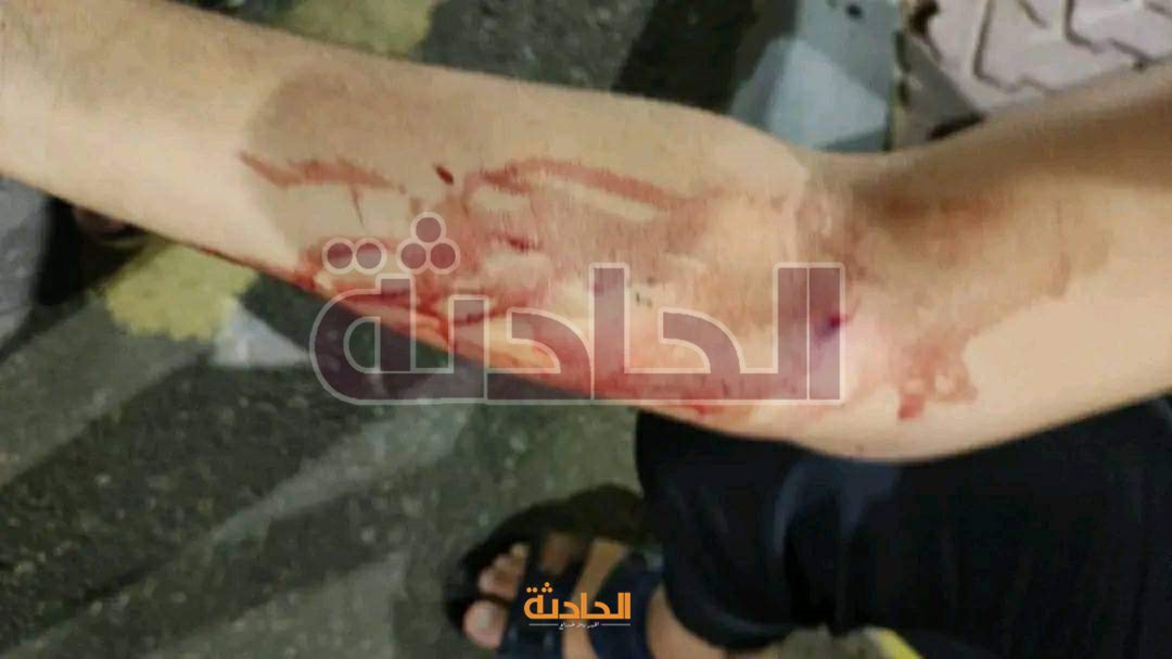 صور المسروقات والمصابين في حادث العاصمة الإدارية