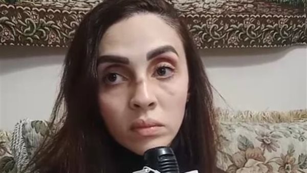 الحادثة
