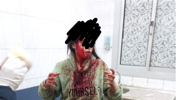 الحادثة