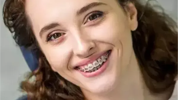 الحادثة