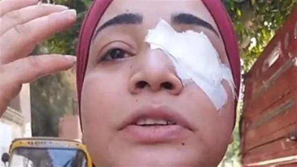 الحادثة
