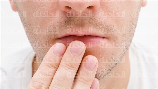 الحادثة