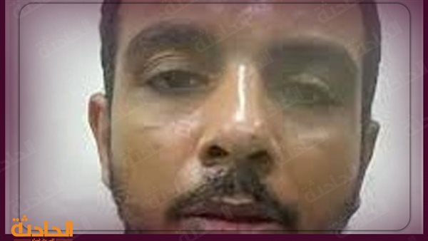 الحادثة