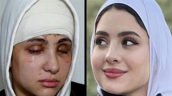الحادثة