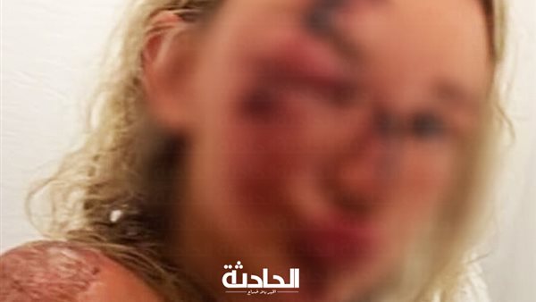 الحادثة