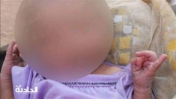 الحادثة