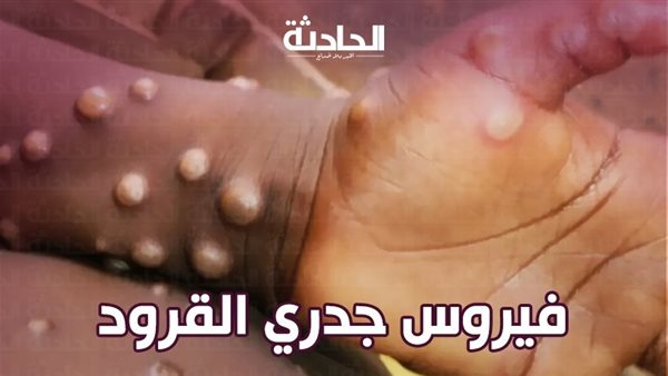 الحادثة