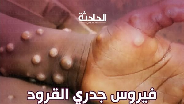 الحادثة