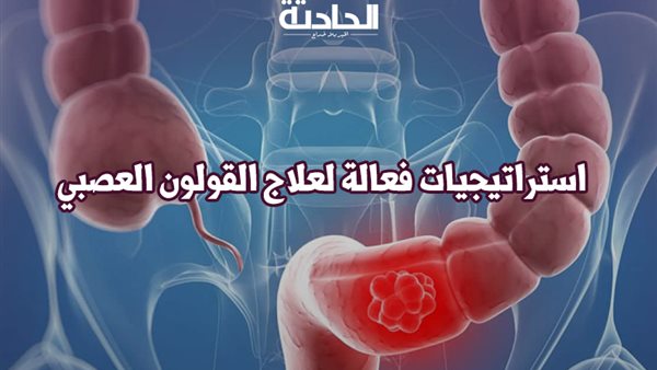 الحادثة