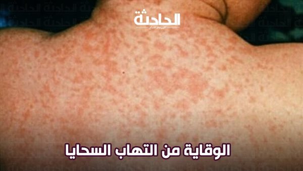 الحادثة